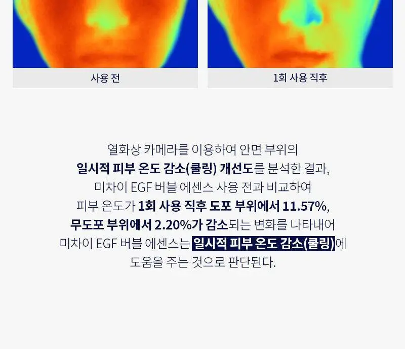 [쿨링/보습/흔적케어] 미차이 EGF 버블 에센스 230ML 상세페이지 20